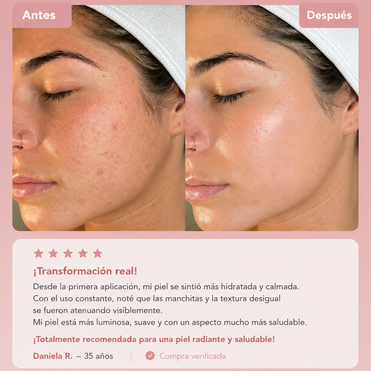 Bio-Colágeno · Efecto Lifting en una noche
